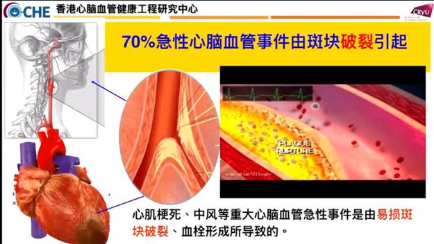 2022.11.21放射学院系列学术讲座-00_12_59-2022_11_21_16_24_48